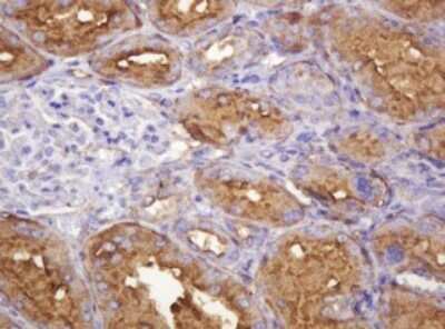 Immunohistochemistry: ATP6V1B2 Antibody (OTI1E11) [NBP2-45525]