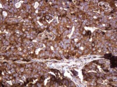 Immunohistochemistry: ATP6V1B2 Antibody (OTI1E11) [NBP2-45525]