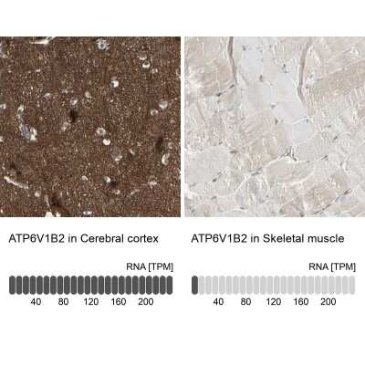 Immunohistochemistry-Paraffin: ATP6V1B2 Antibody [NBP1-88890]