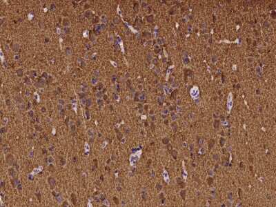 Immunohistochemistry-Paraffin: ATP6V1B2 Antibody [NBP2-97188]