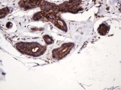 Immunohistochemistry: ATP6V1B2 Antibody (OTI1E11) - Azide and BSA Free [NBP2-70238]