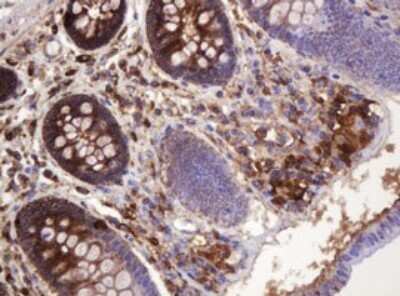 Immunohistochemistry: ATP6V1B2 Antibody (OTI1E11) - Azide and BSA Free [NBP2-70238]