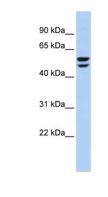 Western Blot: ATP6V1B2 Antibody [NBP1-54759]
