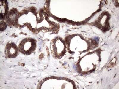 Immunohistochemistry: ATP6V1C2 Antibody (OTI8H4) [NBP2-46556]