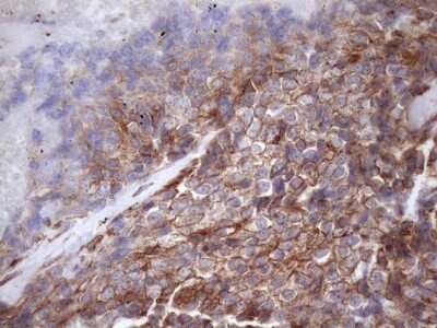 Immunohistochemistry: ATP6V1C2 Antibody (OTI8H4) [NBP2-46556]