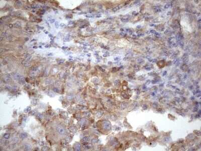 Immunohistochemistry: ATP6V1C2 Antibody (OTI8H4) [NBP2-46556]