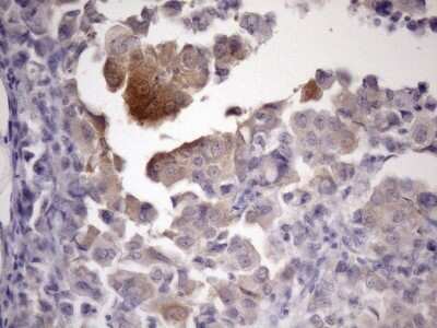 Immunohistochemistry: ATP6V1C2 Antibody (OTI8H4) [NBP2-46556]