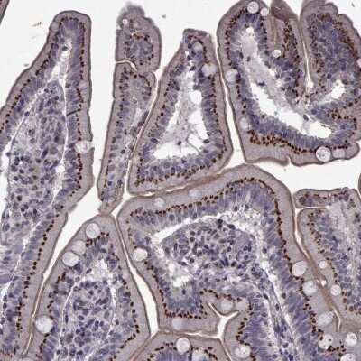 ATP6V1C2 Antibody [NBP2-68854]