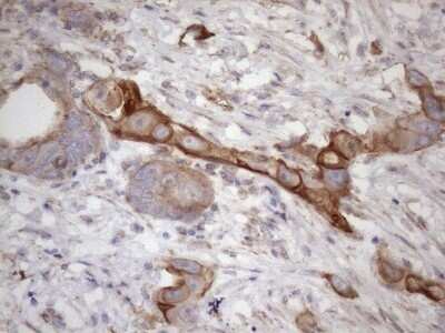 Immunohistochemistry: ATP6V1C2 Antibody (OTI8H4) - Azide and BSA Free [NBP2-72465]