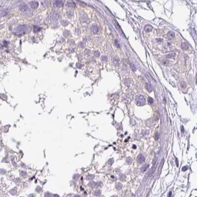 Immunohistochemistry-Paraffin: ATP6V1D Antibody [NBP1-88895]