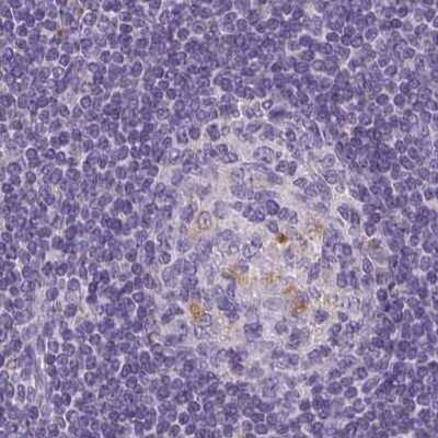 Immunohistochemistry-Paraffin: ATP6V1D Antibody [NBP1-88895]
