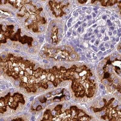 Immunohistochemistry-Paraffin: ATP6V1D Antibody [NBP1-88895]