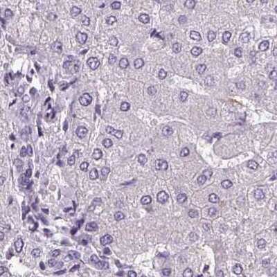 Immunohistochemistry-Paraffin: ATP6V1D Antibody [NBP1-88895]