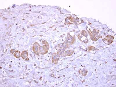 Immunohistochemistry-Paraffin: ATP6V1D Antibody [NBP2-15518]