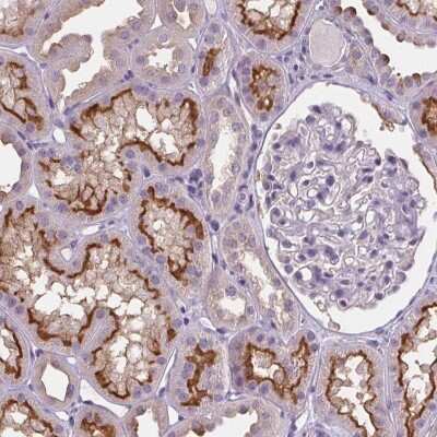 Immunohistochemistry-Paraffin: ATP6V1D Antibody [NBP2-49254]