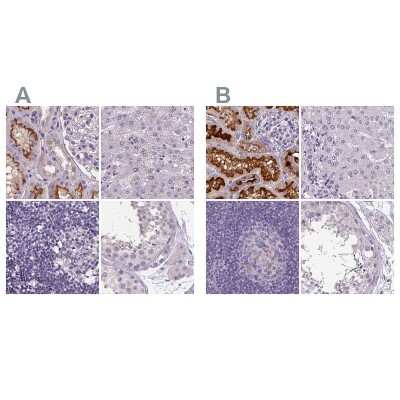 Immunohistochemistry-Paraffin: ATP6V1D Antibody [NBP2-49254]