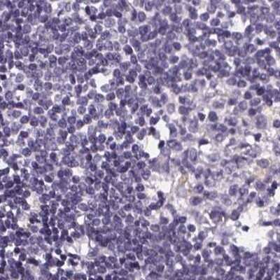 Immunohistochemistry-Paraffin: ATP6V1D Antibody [NBP2-49254]