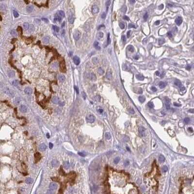 Immunohistochemistry-Paraffin: ATP6V1D Antibody [NBP2-49254]