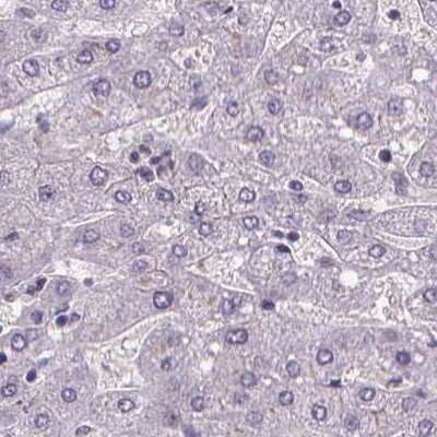 Immunohistochemistry-Paraffin: ATP6V1D Antibody [NBP2-49254]