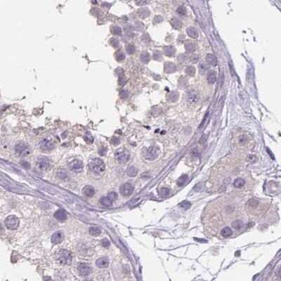 Immunohistochemistry-Paraffin: ATP6V1D Antibody [NBP2-49254]