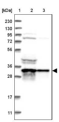 Western Blot: ATP6V1D Antibody [NBP1-88895]