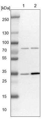 Western Blot: ATP6V1D Antibody [NBP1-88895]