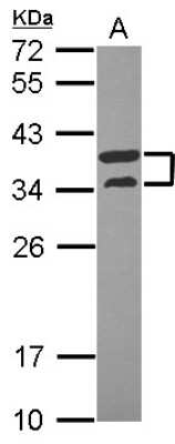 Western Blot: ATP6V1D Antibody [NBP2-15518]