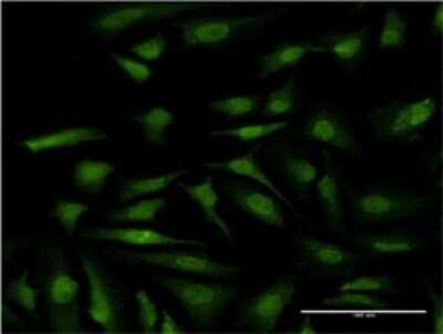 Immunocytochemistry/ Immunofluorescence: ATP6V1E1 Antibody (4E11) [H00000529-M02]