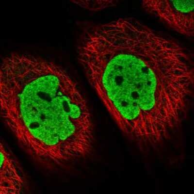 Immunocytochemistry/ Immunofluorescence: ATP6V1E1 Antibody [NBP2-14335]