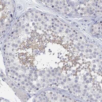 Immunohistochemistry-Paraffin: ATP6V1E2 Antibody [NBP3-17046]