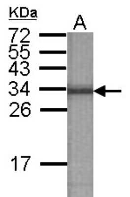 Western Blot: ATP6V1E2 Antibody [NBP2-15521]