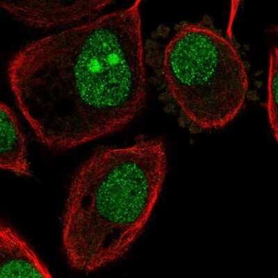 Immunocytochemistry/ Immunofluorescence: ATP6V1G1 Antibody [NBP2-55232]
