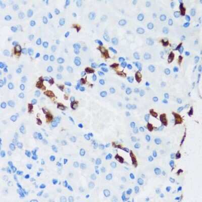 Immunohistochemistry-Paraffin: ATP6V1G3 Antibody - Azide and BSA Free [NBP2-92742]