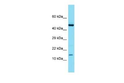 Western Blot: ATP6V1G3 Antibody [NBP2-87056]
