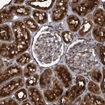 Immunohistochemistry-Paraffin: ATP6V1H Antibody [NBP1-85668]
