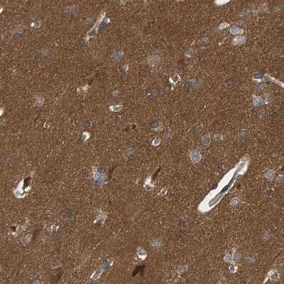 Immunohistochemistry-Paraffin: ATP6V1H Antibody [NBP1-85668]
