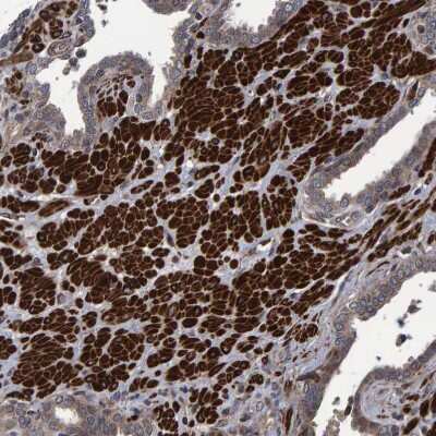Immunohistochemistry-Paraffin: ATP6V1H Antibody [NBP1-85668]