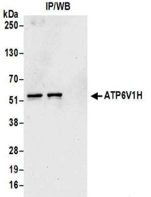 Immunoprecipitation: ATP6V1H Antibody [NBP2-32203]