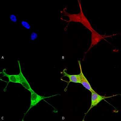 Immunocytochemistry/ Immunofluorescence: ATP7A Antibody (S60-4) [NBP2-59376]