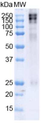 Western Blot: ATP7A Antibody (S60-4) [NBP2-59376]