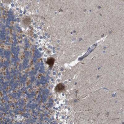 Immunohistochemistry-Paraffin: ATP7b Antibody [NBP2-48523]
