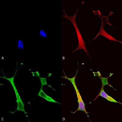 Immunocytochemistry/ Immunofluorescence: ATP7b Antibody (S62-29) [NBP2-59375]