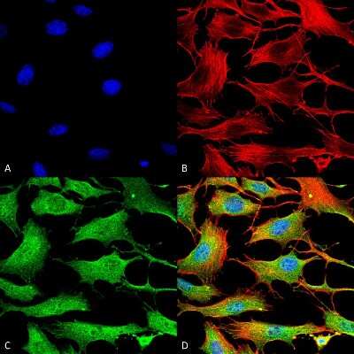 Immunocytochemistry/ Immunofluorescence: ATP7b Antibody (S62-29) [NBP2-59375]