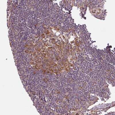 Immunohistochemistry-Paraffin: ATP8A1 Antibody [NBP2-30403]