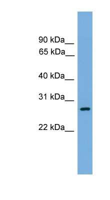 Western Blot: ATPAF1 Antibody [NBP1-56969]