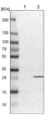 Western Blot: ATPAF2 Antibody [NBP1-88885]