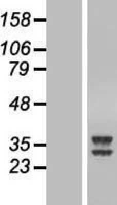 Western Blot: ATPAF2 Overexpression Lysate [NBL1-07850]