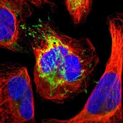 ATPB Antibody - BSA Free NBP1-90815: Novus Biologicals