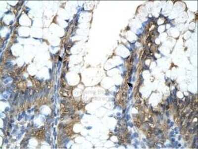 Immunohistochemistry-Paraffin: ATPB Antibody [NBP1-54700]