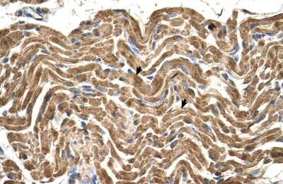 Immunohistochemistry-Paraffin: ATPB Antibody [NBP1-54700]